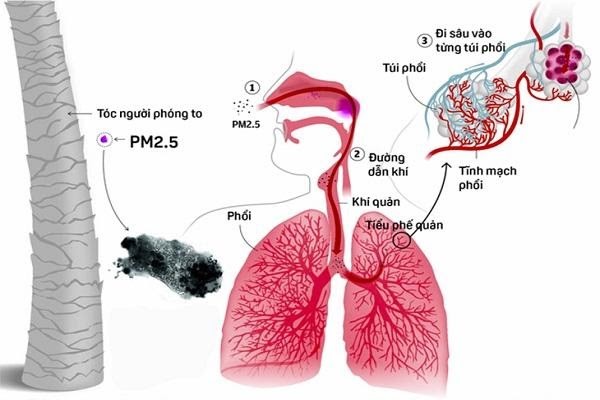 WHAT IS PM 2.5 MASK? THE IMPORTANCE OF MASKS PM 2.5 - EcomMed